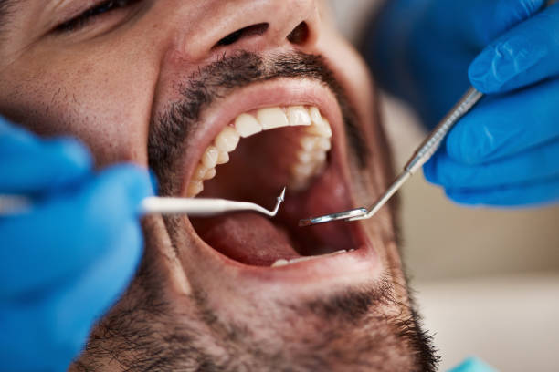 Best Emergency Dentist for Knocked-Out Tooth in Brass Castle, NJ